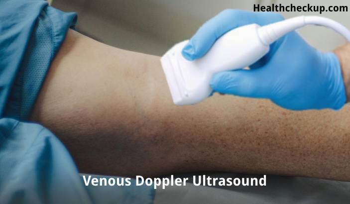 Venous Doppler Ultrasound - Purpose, Procedure, Results Interpretation