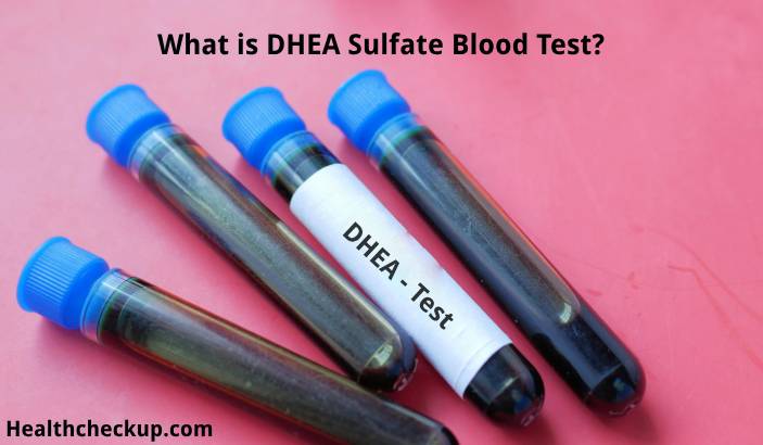 DHEA Sulfate Blood Test: What is it, Purpose, Normal Range, Results