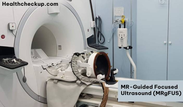 MR-Guided Focused Ultrasound (MRgFUS)