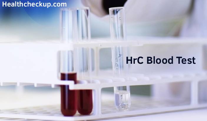 HrC Blood Test for Cancer: How Promising It Really Is?